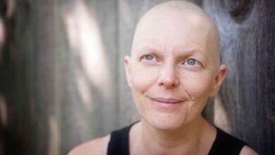 Chemotherapy And Hair Loss Related All Information You Need Know